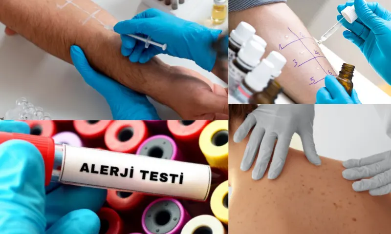Alerji Testi: Sağlığınızı Korumanın İlk Adımı